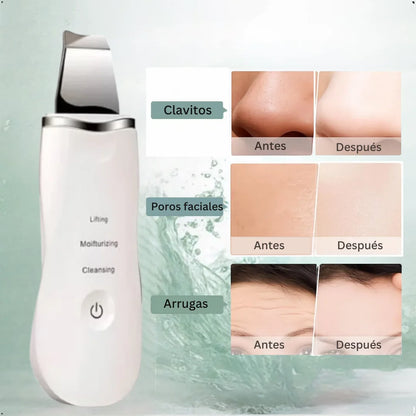 PALA FACIAL EXFOLIANATE ULTRASONICA